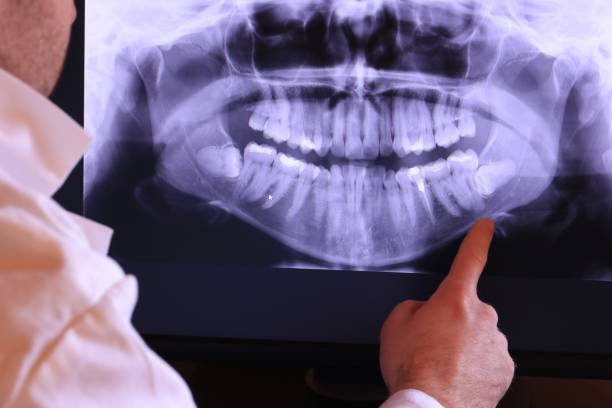 Best Emergency Wisdom Teeth Removal in Liberty City, TX