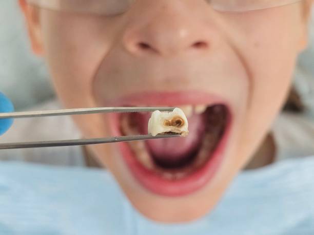 Best Pediatric Emergency Dentist in Liberty City, TX
